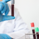 Exames Laboratoriais em Mogi das Cruzes – saiba quando fazer exames de análises clínicas?